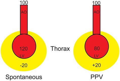 lv transmural pressure|how does nippv decrease afterload.